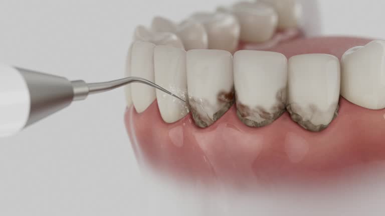 Reliable Tooth Extraction contractor in Ray County County, MO by Dentist Open Now